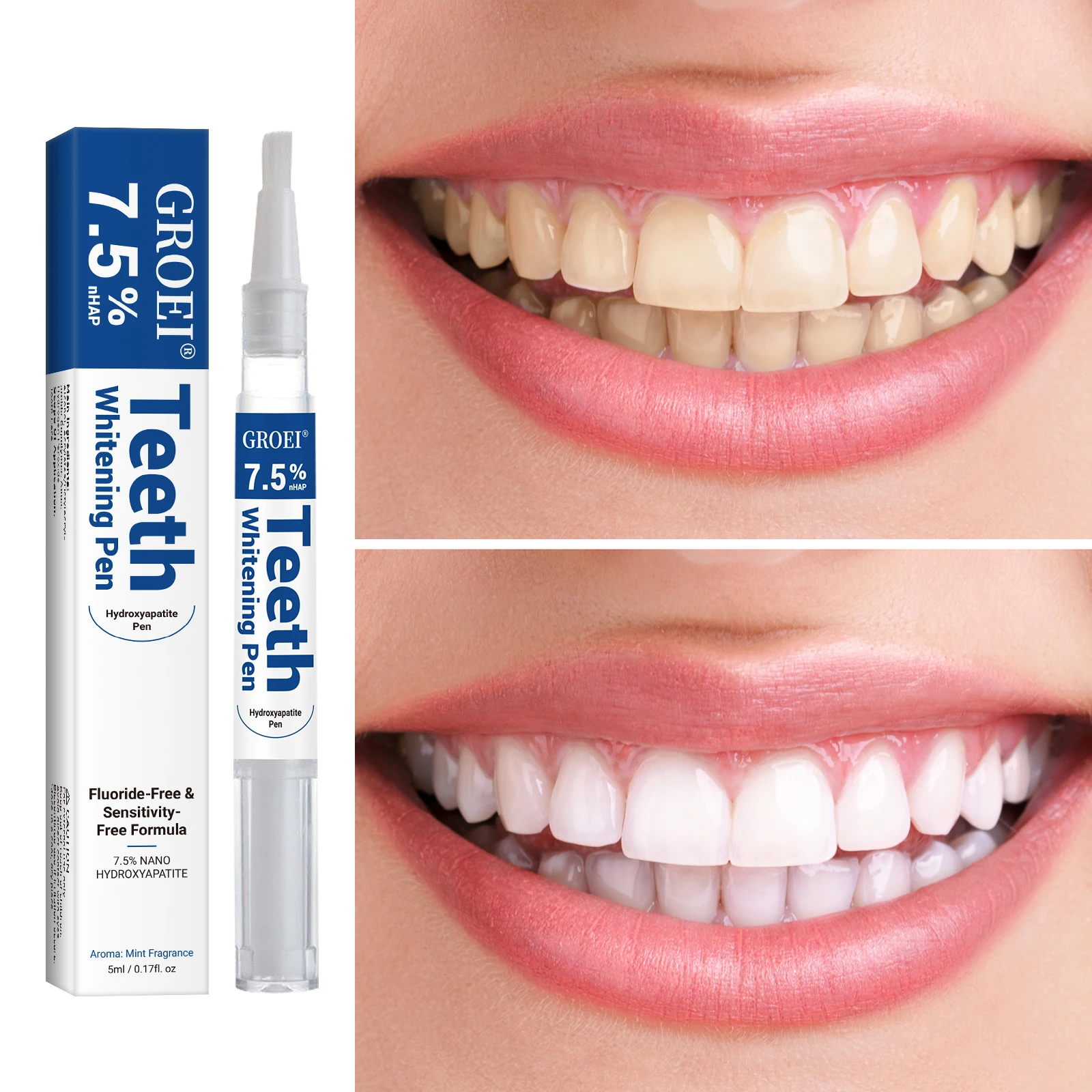 하이드록시아파타이트 치아 미백 펜 눈부신 화이트 얼룩  - Teeth Whitening Q&M 리뷰 및 가격