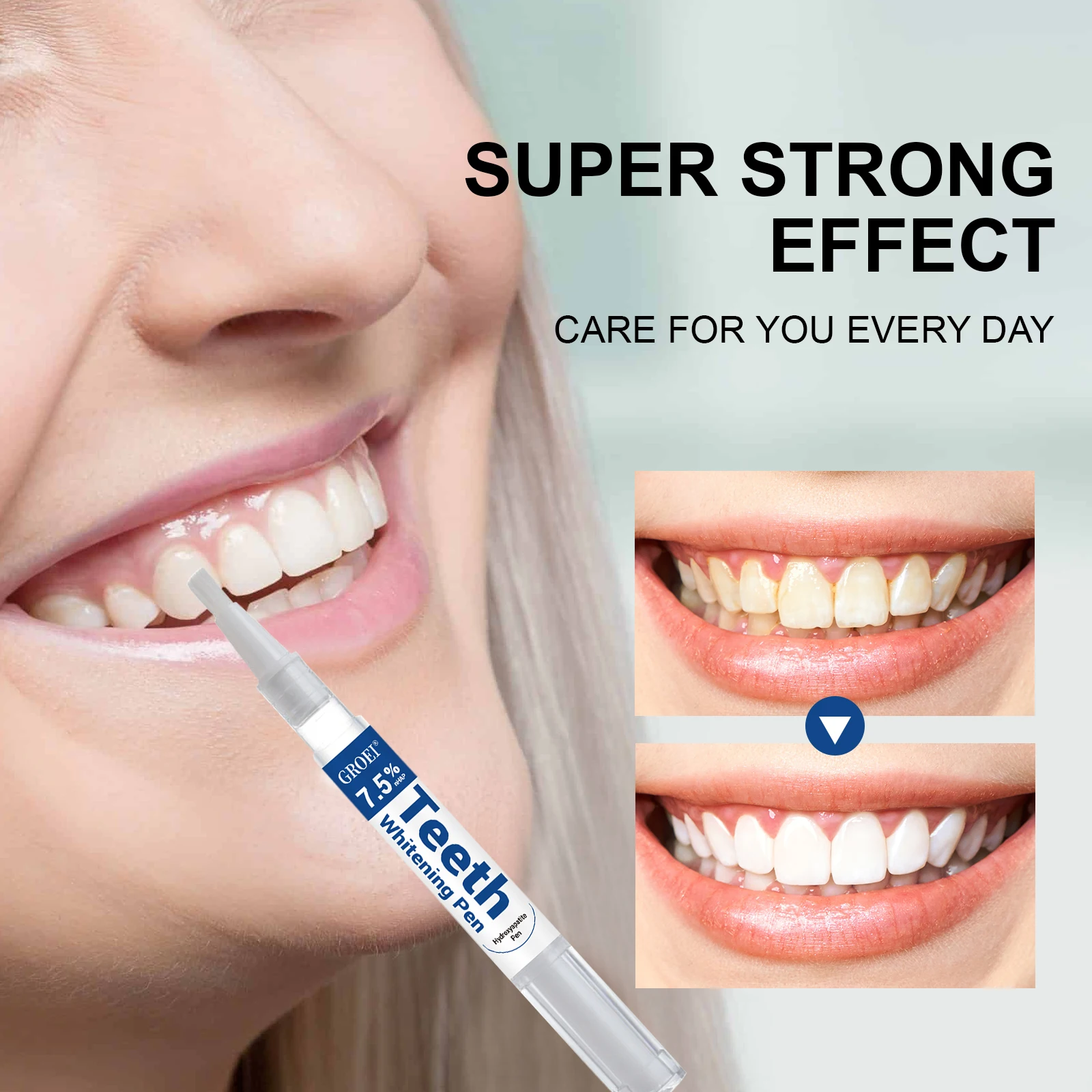 하이드록시아파타이트 치아 미백 펜 눈부신 화이트 얼룩  - Teeth Whitening Q&M 리뷰 및 가격