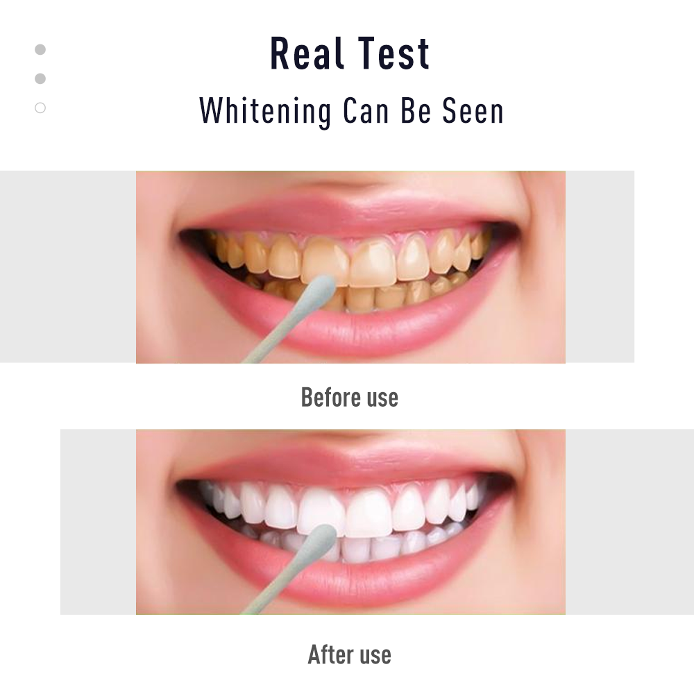 펜 치아 젤 화이트 키트, 얼룩 제거, 미백, 구강 위 - Whitening Pen Bleach 리뷰 및 가격