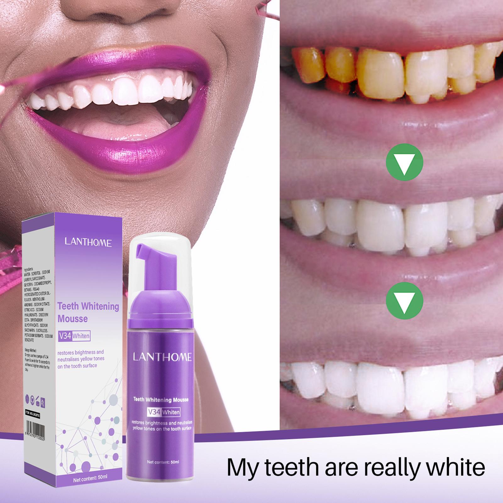 50MLTeeth 화이트닝 무스 얼룩 제거 신선한 호흡 - Teeth Whitening Foam Toothpaste 리뷰 및 가격