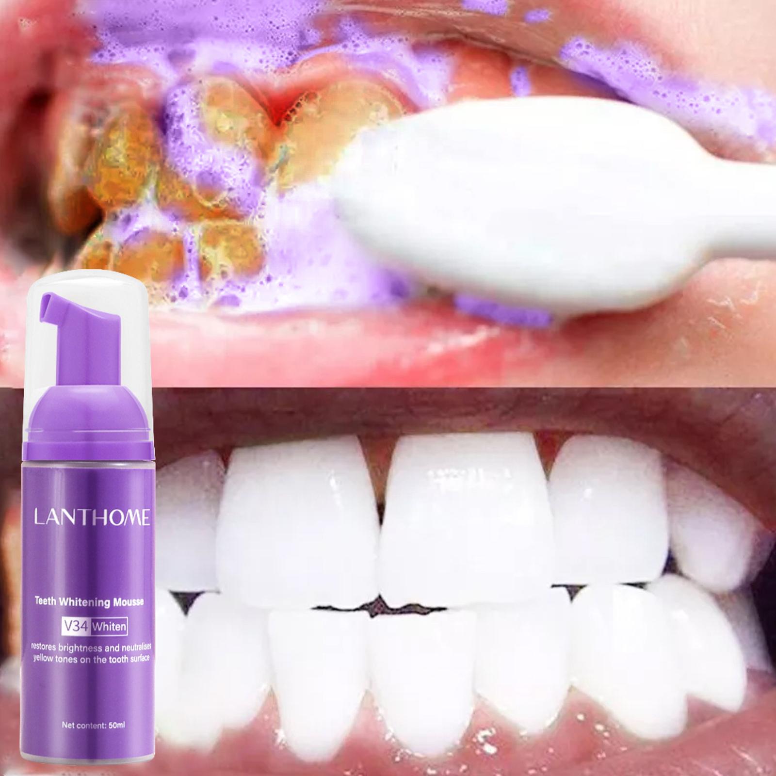 50MLTeeth 화이트닝 무스 얼룩 제거 신선한 호흡 - Teeth Whitening Foam Toothpaste 리뷰 및 가격