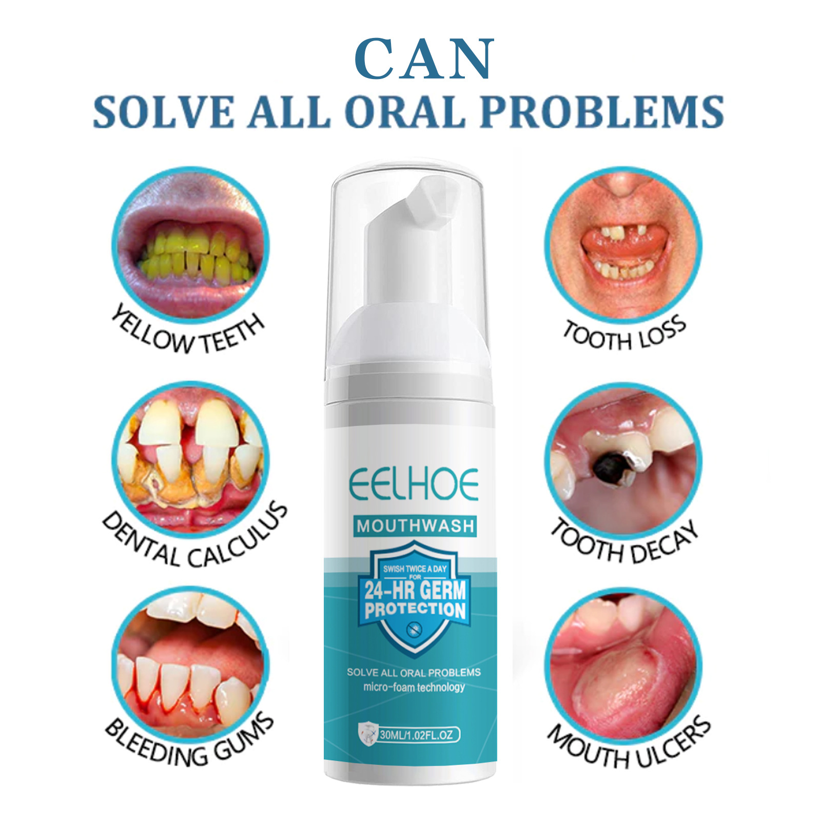 EELHOE 치아 미백 청소 무스 치아 얼룩 제거 안티 - Teeth Whitening Foam Toothpaste 리뷰 및 가격