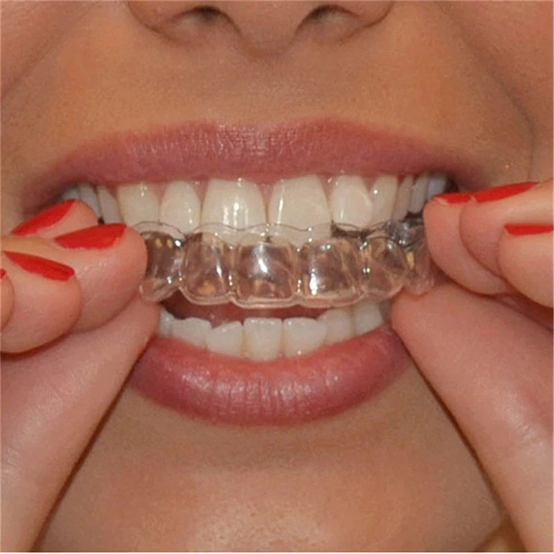 안티 코골이 Bruxism 슬리핑 입 가드 나이트 가드 - Teeth Whitening Retainer 리뷰 및 가격
