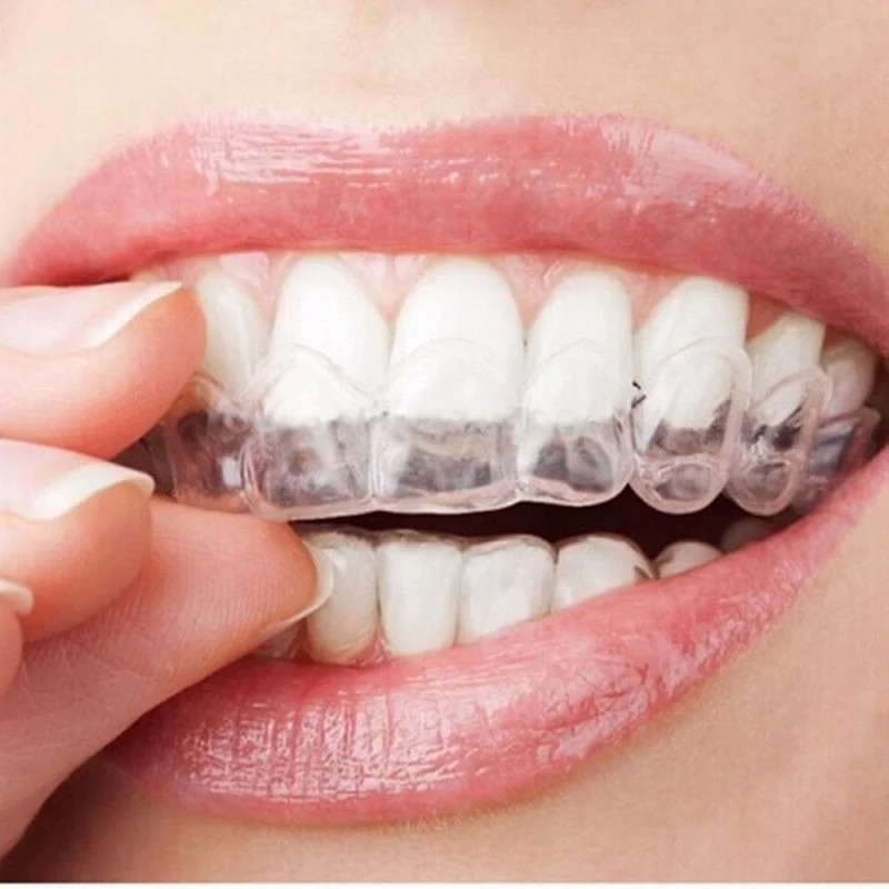 안티 코골이 Bruxism 슬리핑 입 가드 나이트 가드 - Teeth Whitening Retainer 리뷰 및 가격