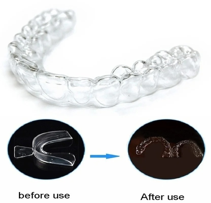 안티 코골이 Bruxism 슬리핑 입 가드 나이트 가드 - Teeth Whitening Retainer 리뷰 및 가격