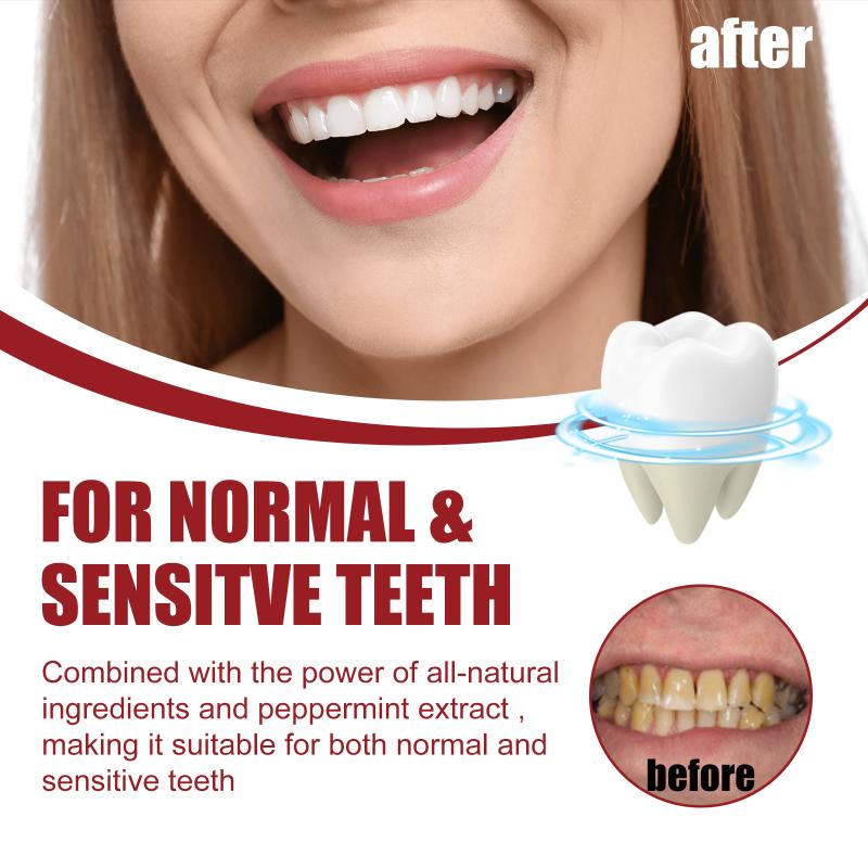 SP-5 프로바이오틱 치약 화이트닝 치약 구취 제거 치 - Teeth Whitening Foam Toothpaste 리뷰 및 가격