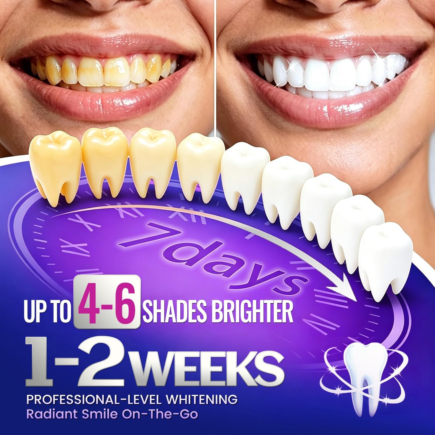 1/7 쌍의 치아 미백 스트립으로 더 하얗게 보이는 미 - Teeth Whitening Retainer 리뷰 및 가격