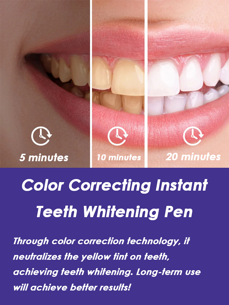 치아 미백 펜 효과적인 플라크 제거 구강 위생 청소 치 - Whitening Pen Bleach 리뷰 및 가격
