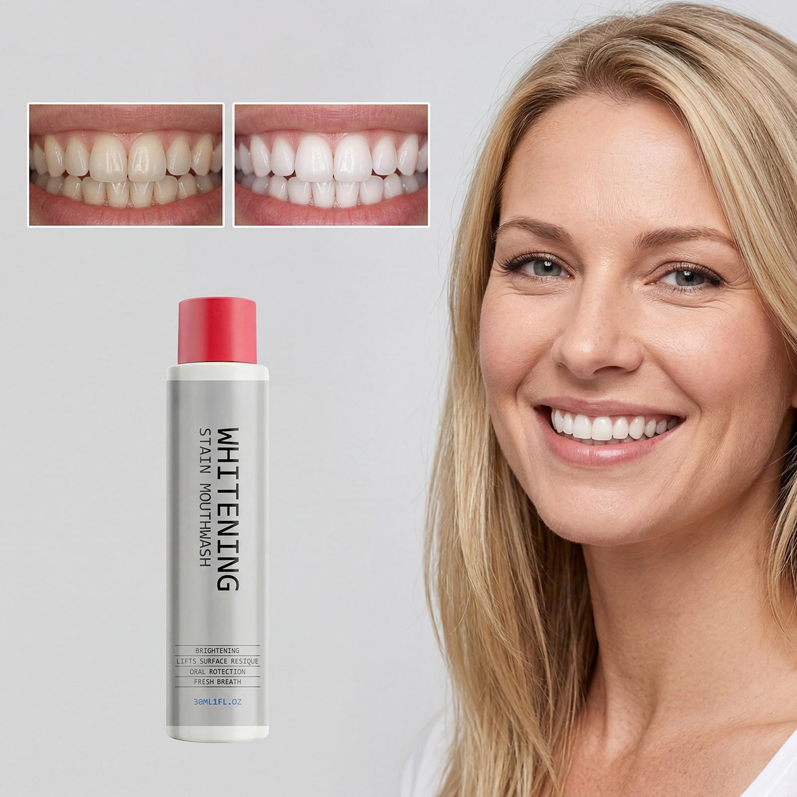 30ml 얼룩 제거 구강청결제, 냄새 제거, 치아 미백 - Whitening Mouthwash 리뷰 및 가격