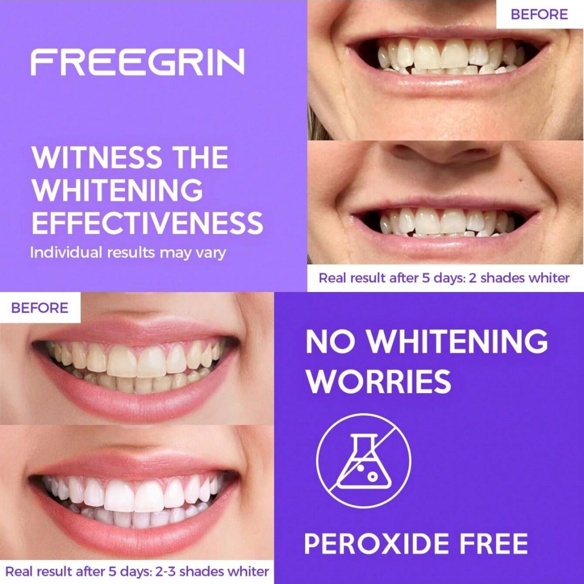 디럭스 화이트닝 치아 스티커 7/14/21 쌍 젤 화이 - Teeth Whitening Q&M 리뷰 및 가격