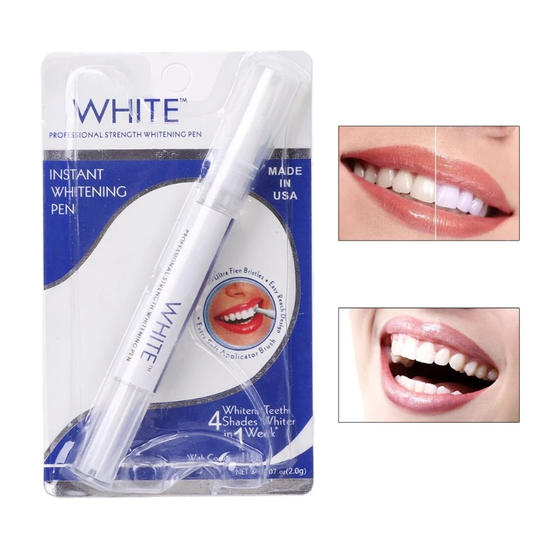 인스턴트 화이트 치아 미백 펜, 사용하기 쉬운 치아 표 - Whitening Pen Bleach 리뷰 및 가격