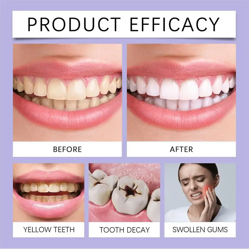 빠른 치아 미백 치약 펜 플라크 얼룩 제거 구강 위생  - Whitening Pen Bleach 리뷰 및 가격